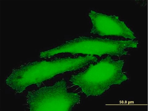 Anti-MAGEE1 antibody produced in mouse purified immunoglobulin, buffered aqueous solution