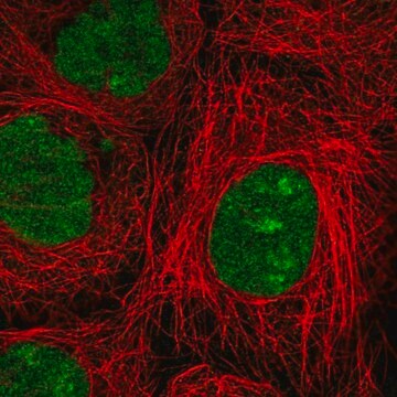 Anti-NSMCE2 antibody produced in rabbit affinity isolated antibody