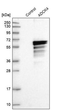 Anti-COQ8B antibody produced in rabbit Prestige Antibodies&#174; Powered by Atlas Antibodies, affinity isolated antibody, buffered aqueous glycerol solution, ab2