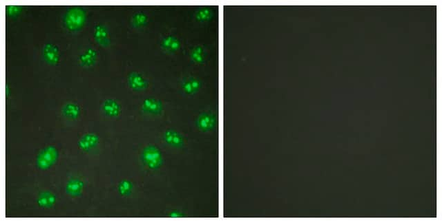 Anti-p57 KIP2 antibody produced in rabbit affinity isolated antibody