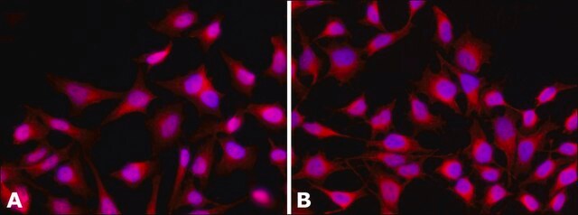 Anti-Histone Deacetylase 4 (HDAC4) antibody, Mouse monoclonal clone HDAC4-144, purified from hybridoma cell culture