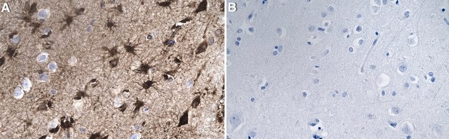 Anti-GLUL Antibody, clone 1D15 ZooMAb&#174; Rabbit Monoclonal recombinant, expressed in HEK 293 cells