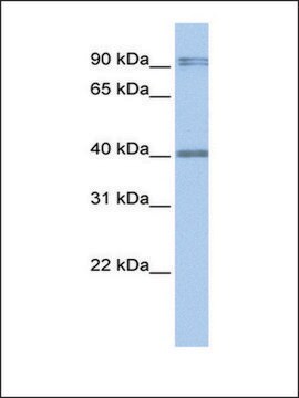 Anti-AIM2 antibody produced in rabbit affinity isolated antibody