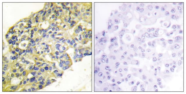 Anti-PI3-kinase p85-&#945; antibody produced in rabbit affinity isolated antibody