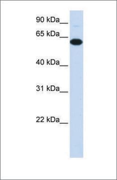 Anti-FBXO24 (ab4) antibody produced in rabbit affinity isolated antibody