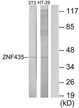 Anti-ZNF435 antibody produced in rabbit affinity isolated antibody