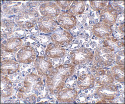 Anti-MTCH2 antibody produced in rabbit affinity isolated antibody, buffered aqueous solution