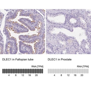 Anti-DLEC1 antibody produced in rabbit Prestige Antibodies&#174; Powered by Atlas Antibodies, affinity isolated antibody, buffered aqueous glycerol solution