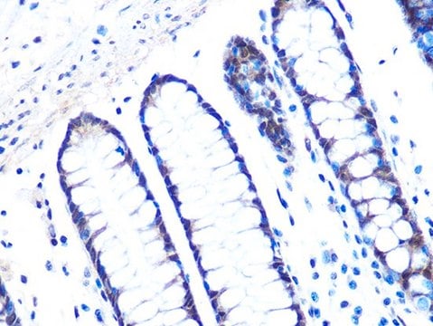 Anti-14-3-3 sigma antibody produced in rabbit