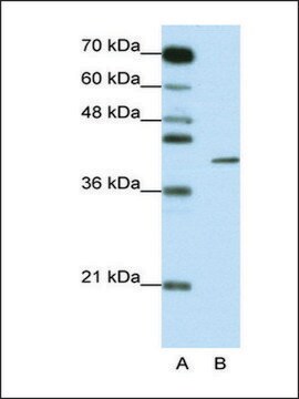 Anti-ZFP42 antibody produced in rabbit affinity isolated antibody