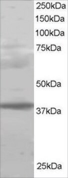 Anti-MEL18/PCGF2 antibody produced in goat affinity isolated antibody, buffered aqueous solution