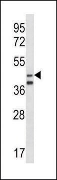 ANTI-ORC5L (CENTER) antibody produced in rabbit IgG fraction of antiserum, buffered aqueous solution