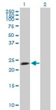 Anti-TPD52L1 antibody produced in mouse purified immunoglobulin, buffered aqueous solution