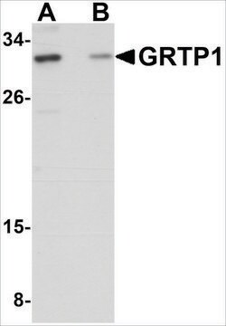 Anti-GRTP1 (ab2) antibody produced in rabbit affinity isolated antibody, buffered aqueous solution