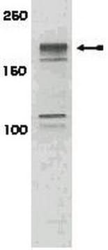 Anti-phospho-IRS1 (Ser616) Antibody Upstate&#174;, from rabbit