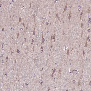 Anti-TOMM40 antibody produced in rabbit Prestige Antibodies&#174; Powered by Atlas Antibodies, affinity isolated antibody, buffered aqueous glycerol solution