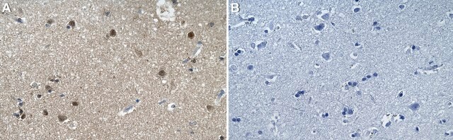 Anti-USP11 Antibody, clone 1E15 ZooMAb&#174; Rabbit Monoclonal recombinant, expressed in HEK 293 cells