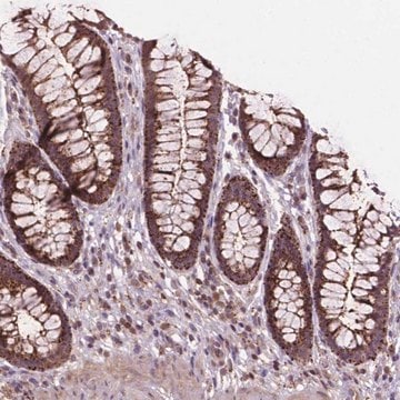 Anti-CHMP4A antibody produced in rabbit Prestige Antibodies&#174; Powered by Atlas Antibodies, affinity isolated antibody, buffered aqueous glycerol solution