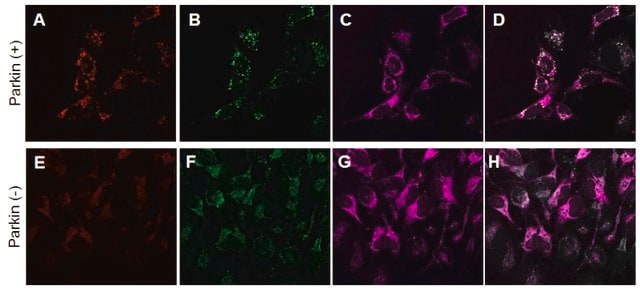 BioTracker&#8482; Mitophagy Detection Kit