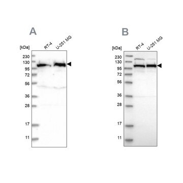 Anti-IARS2 antibody produced in rabbit Prestige Antibodies&#174; Powered by Atlas Antibodies, affinity isolated antibody, buffered aqueous glycerol solution, Ab2