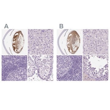 Anti-LGSN antibody produced in rabbit Prestige Antibodies&#174; Powered by Atlas Antibodies, affinity isolated antibody