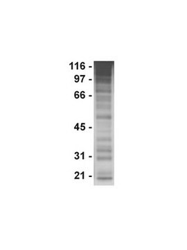 Anticorps anti-phosphotyrosine, clone&nbsp;PY20 clone PY20, Upstate&#174;, from mouse