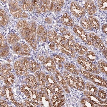 Anti-ZIK1 antibody produced in rabbit Prestige Antibodies&#174; Powered by Atlas Antibodies, affinity isolated antibody, buffered aqueous glycerol solution