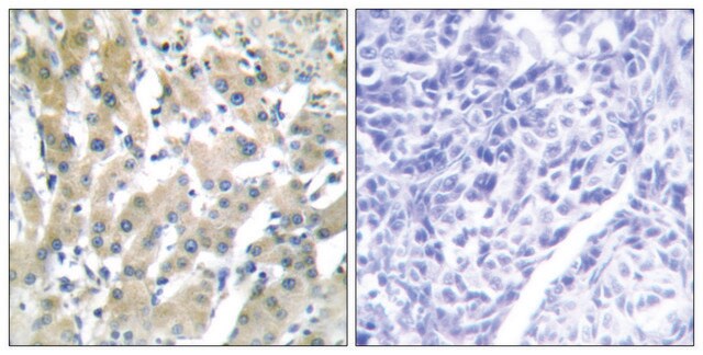 Anti-THRB antibody produced in rabbit affinity isolated antibody