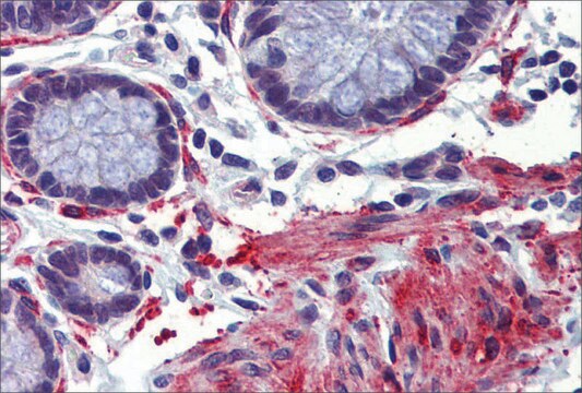 Anti-CREBBP antibody produced in rabbit affinity isolated antibody