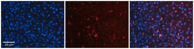 Anti-OSBPL8 antibody produced in rabbit affinity isolated antibody