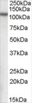 Anti-MP100/NPEPPS antibody produced in goat affinity isolated antibody, buffered aqueous solution