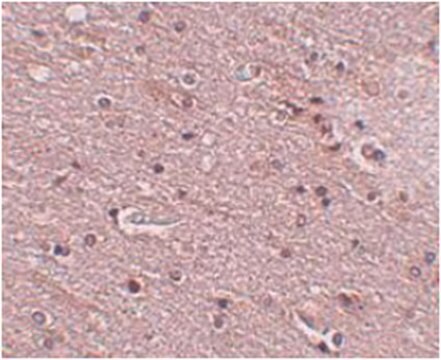 Anti-TMEM16B Antibody from rabbit, purified by affinity chromatography