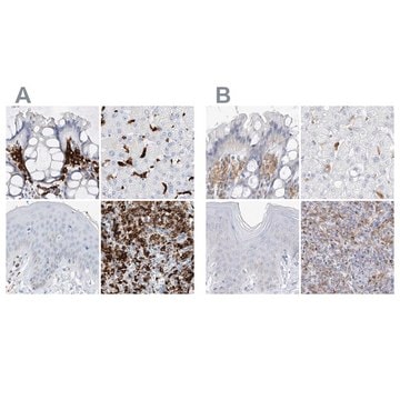 Anti-TBXAS1 antibody produced in rabbit Prestige Antibodies&#174; Powered by Atlas Antibodies, affinity isolated antibody, buffered aqueous glycerol solution