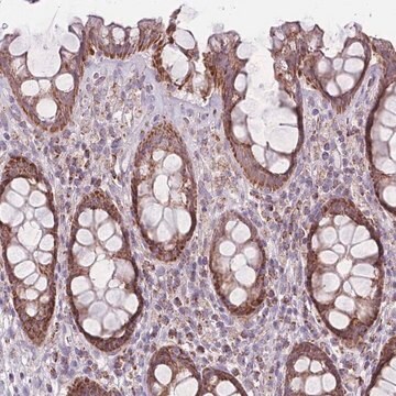 Anti-DCHS1 antibody produced in rabbit Prestige Antibodies&#174; Powered by Atlas Antibodies, affinity isolated antibody, buffered aqueous glycerol solution