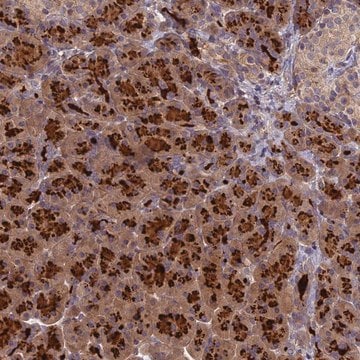 Anti-AP4E1 antibody produced in rabbit Prestige Antibodies&#174; Powered by Atlas Antibodies, affinity isolated antibody, buffered aqueous glycerol solution