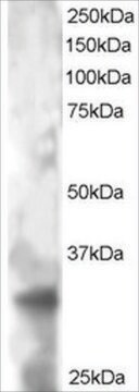 Anti-PHEMX/TSPAN32 antibody produced in goat affinity isolated antibody, buffered aqueous solution