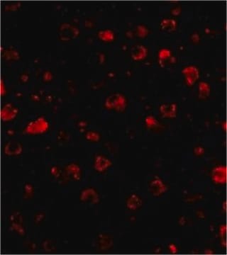 Anti-SATB1 Antibody from rabbit, purified by affinity chromatography