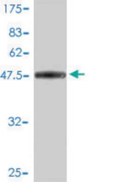 Monoclonal Anti-DSU antibody produced in mouse clone 8F9-1B2, purified immunoglobulin, buffered aqueous solution