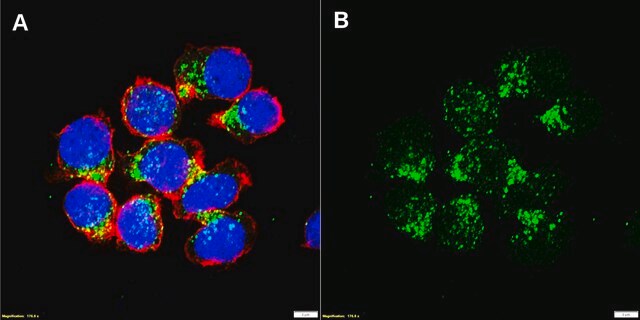 Anti-BTK Antibody, clone 1F5 ZooMAb&#174; Rabbit Monoclonal recombinant, expressed in HEK 293 cells