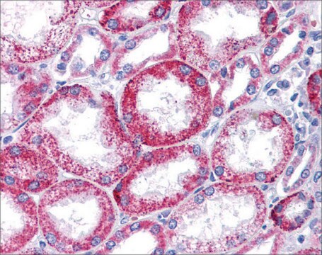 Anti-KCNQ1 affinity isolated antibody