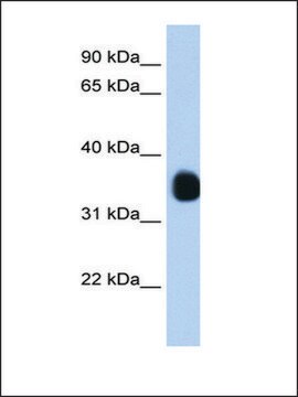 Anti-MLX antibody produced in rabbit IgG fraction of antiserum