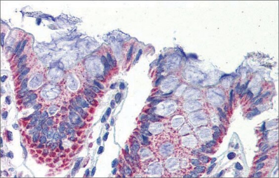 Anti-IMPDH1 antibody produced in rabbit affinity isolated antibody