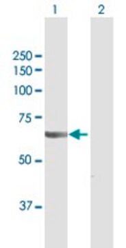 Anti-VPS18 antibody produced in rabbit purified immunoglobulin, buffered aqueous solution