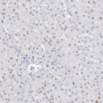 Anti-ZFP64 antibody produced in rabbit Prestige Antibodies&#174; Powered by Atlas Antibodies, affinity isolated antibody, buffered aqueous glycerol solution