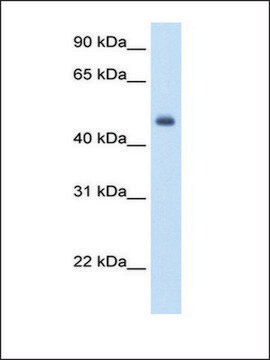 Anti-FOXH1 antibody produced in rabbit affinity isolated antibody