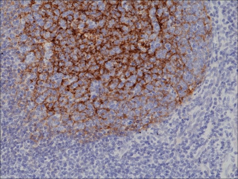 Anti-CD21 antibody, Rabbit monoclonal recombinant, expressed in HEK 293 cells, clone RM372, purified immunoglobulin