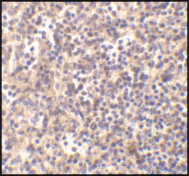 Anti-DNASE II antibody produced in rabbit affinity isolated antibody, buffered aqueous solution