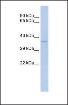 Anti-TRADD antibody produced in rabbit affinity isolated antibody