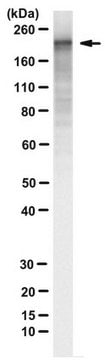 Anti-Adenylate Cyclase Toxin Antibody, B. pertussis Antibody, clone 3D1 clone 3D1, from mouse