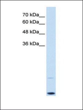 Anti-MyC (AB3) antibody produced in rabbit affinity isolated antibody